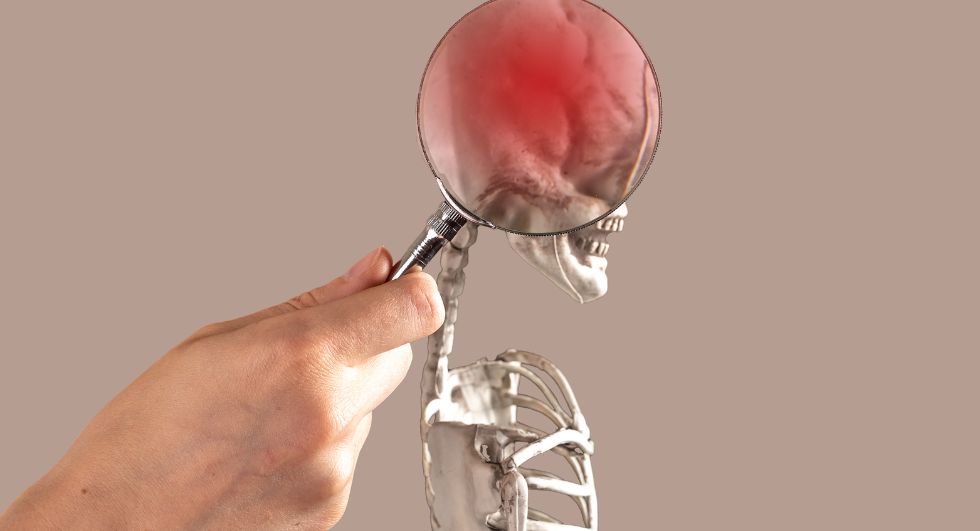 What’s the Legal Basis of My Brain Injury Lawsuit?